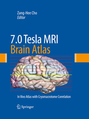 cover image of 7.0 Tesla MRI Brain Atlas